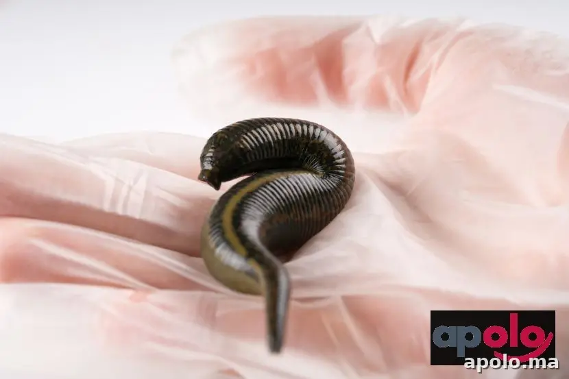 دودة العلقة 